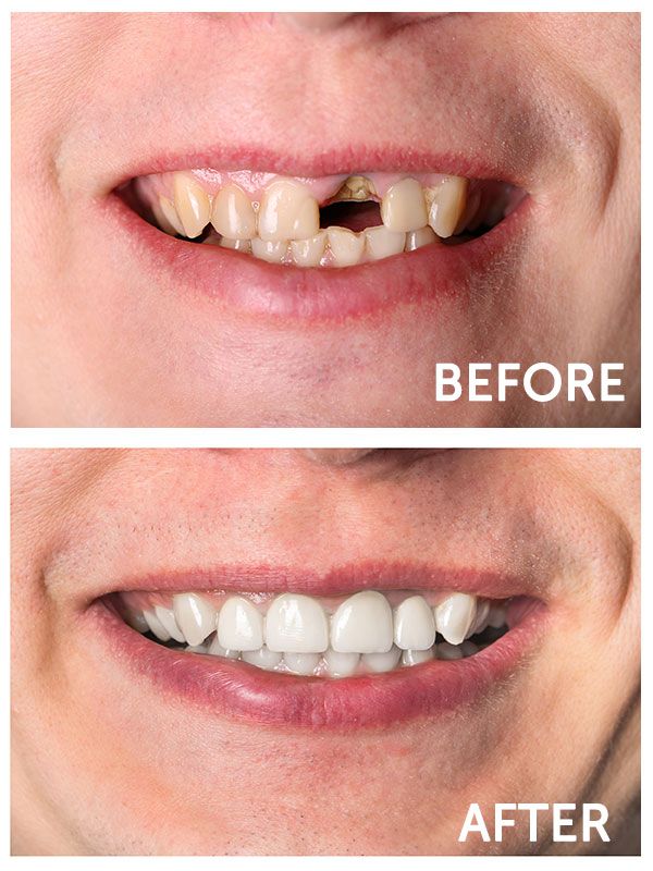 Gallery Dentist in Tucson, AZ